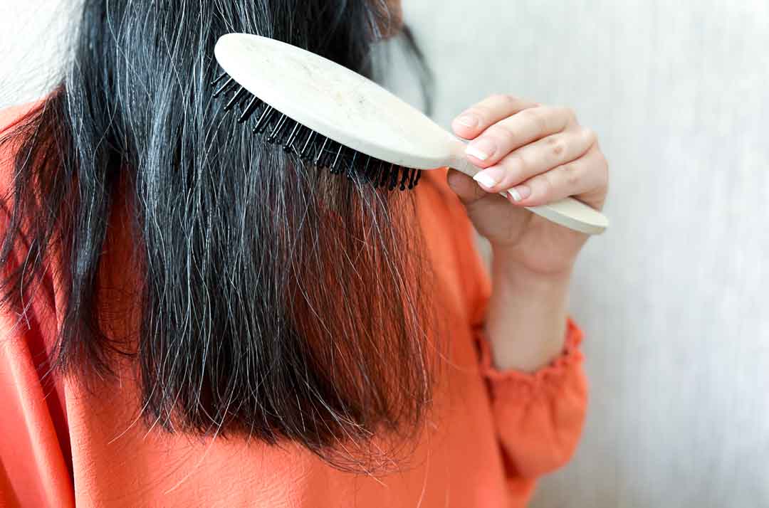 9 راه برای درمان ریزش شدید مو سر خانم ها