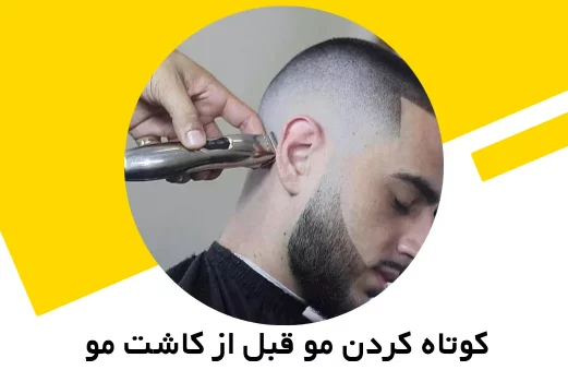 تصویر کوتاه کردن مو قبل از کاشت مو